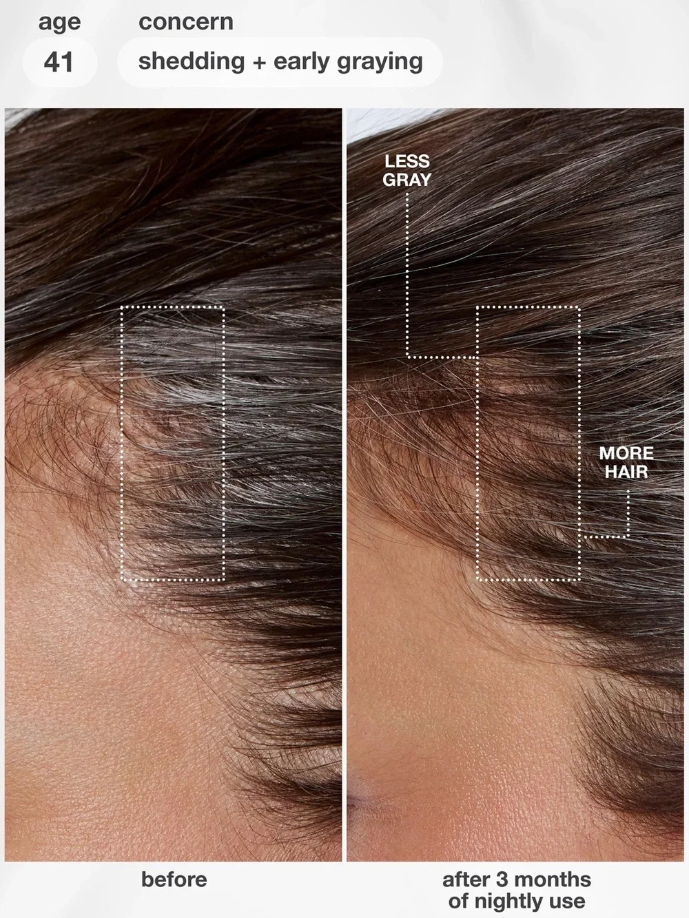 NEW K18 FutureIQ™ biomimetic hair longevity serum